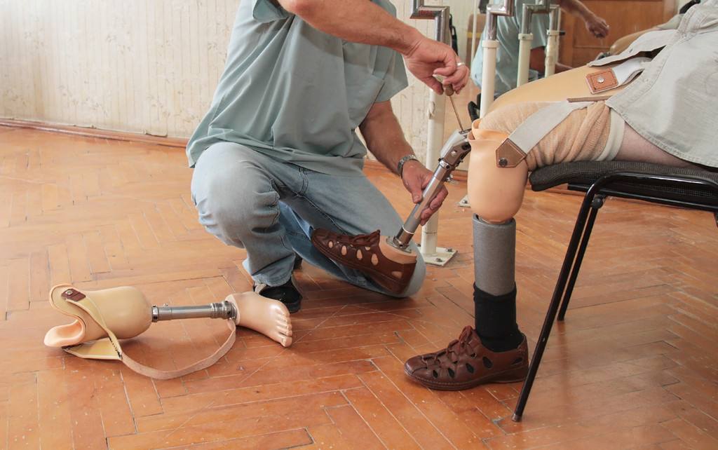 截肢患者穿戴假肢如何减少疼痛郑州力康假肢厂家(图1)