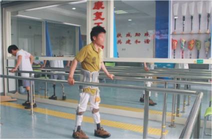 假肢价格